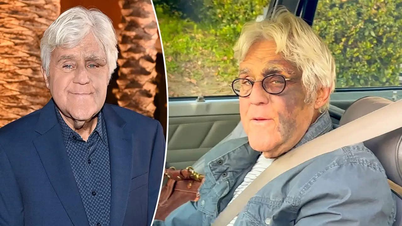 It breaks our hearts to confirm the news about the great Jay Leno, 74It breaks our hearts to confirm the news about the great Jay Leno, 74