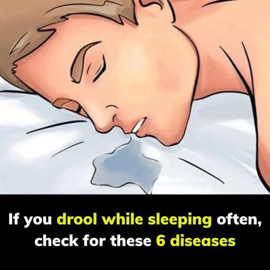 If you drool while sleeping often, check for these 6 diseases