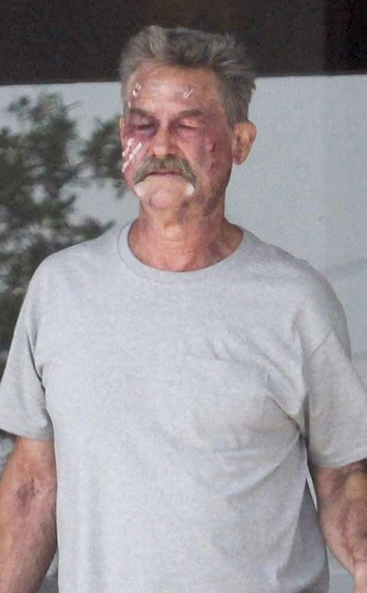 Prayers are needed for Kurt Russell. What happened to him is terrible…