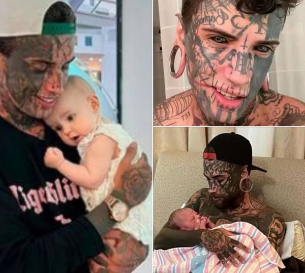 A 24-year-old father, who has several tattoos all over his body, makes the decision to get them erased for his child