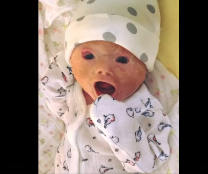 Doctors forced to do emergency caesarean section – dad sees baby’s face and room falls silent