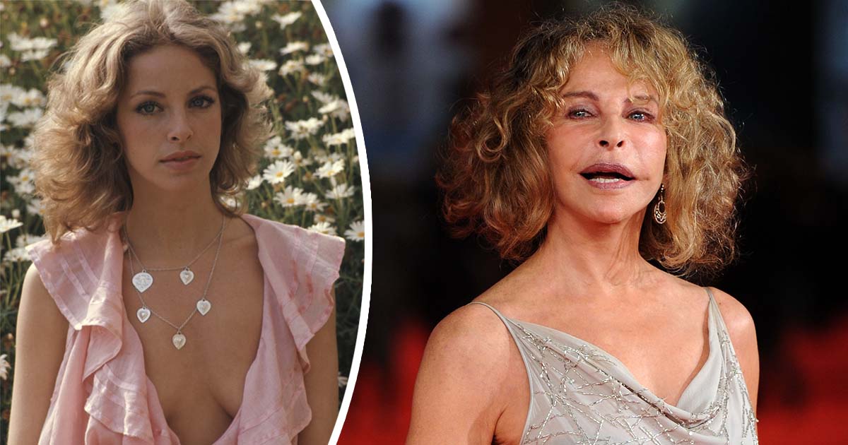 This beloved Hollywood star disappeared after a tragic accident left her scarred for life