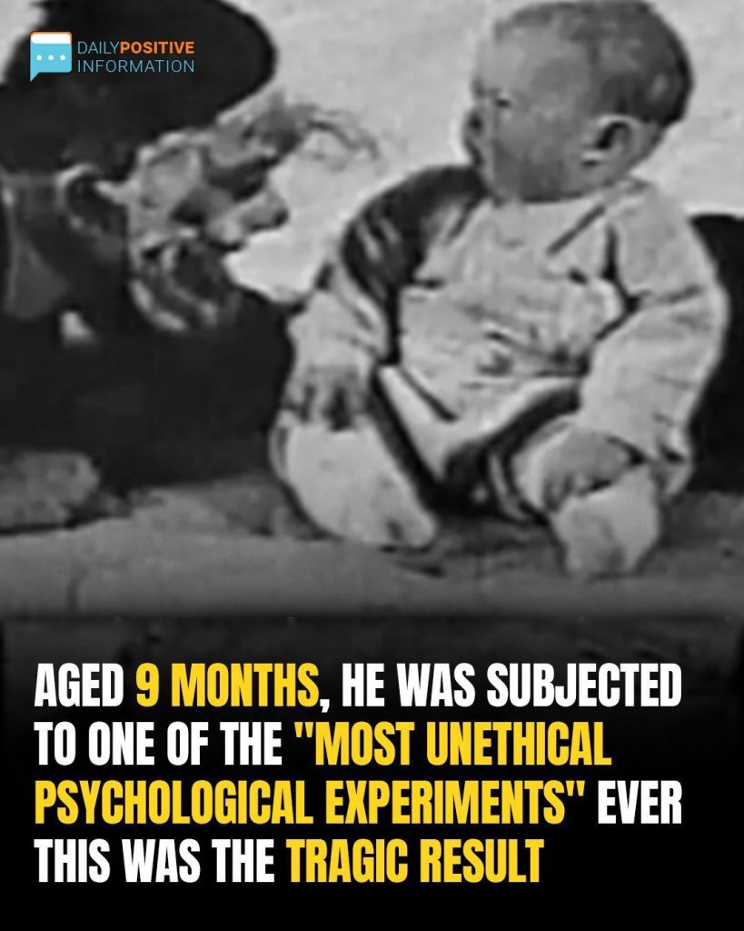 The Heartbreaking Fate Of ‘Little Albert’: Child Subject Of Historic Study Died At Just Six